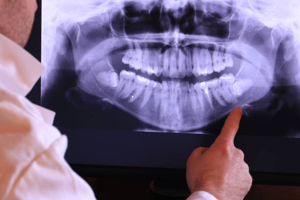 Best Emergency Care for Gum Disease in Trinity, AL